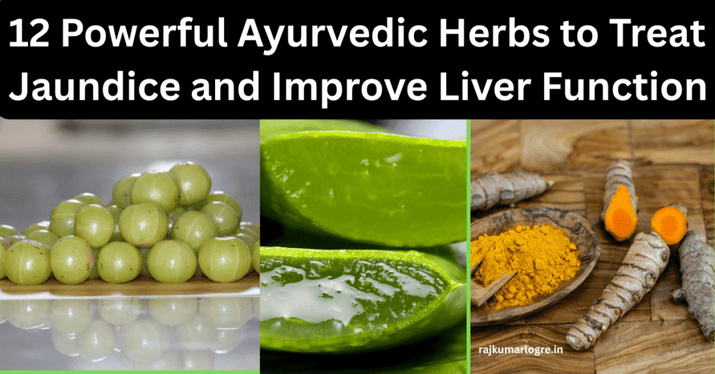 12 Powerful Ayurvedic Herbs to Treat Jaundice and Improve Liver Function 2 Jaundice
