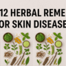 Skin diseases